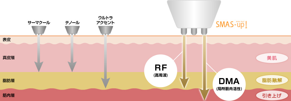 SMAS-UPとは